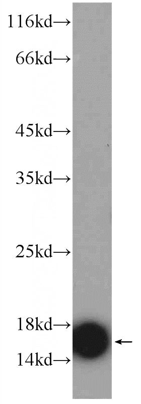 mouse brain tissue were subjected to SDS PAGE followed by western blot with Catalog No:116171(TOM20 Antibody) at dilution of 1:2000