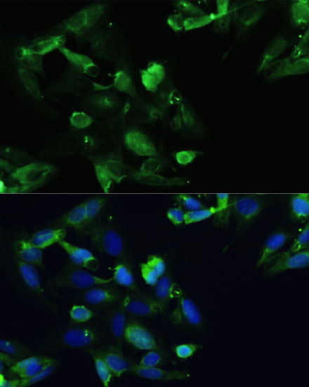 Immunofluorescence - CXCR5 Polyclonal Antibody 