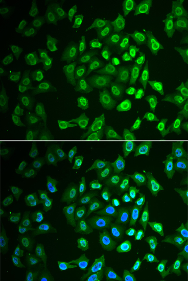 Immunofluorescence - FAH Polyclonal Antibody 