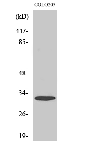 Fig1:; Western Blot analysis of various cells using APHC Polyclonal Antibody