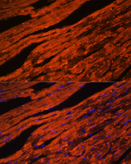 Immunofluorescence - LDB3 Polyclonal Antibody 