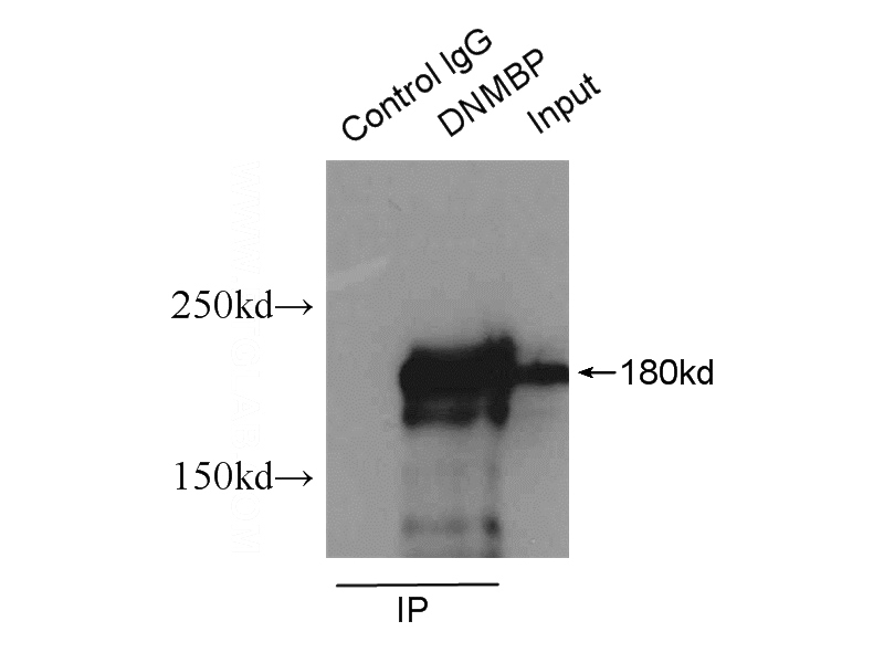 IP Result of anti-DNMBP (IP:Catalog No:109965, 4ug; Detection:Catalog No:109965 1:1000) with mouse testis tissue lysate 10000ug.