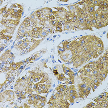 Immunohistochemistry - GNA13 Polyclonal Antibody 