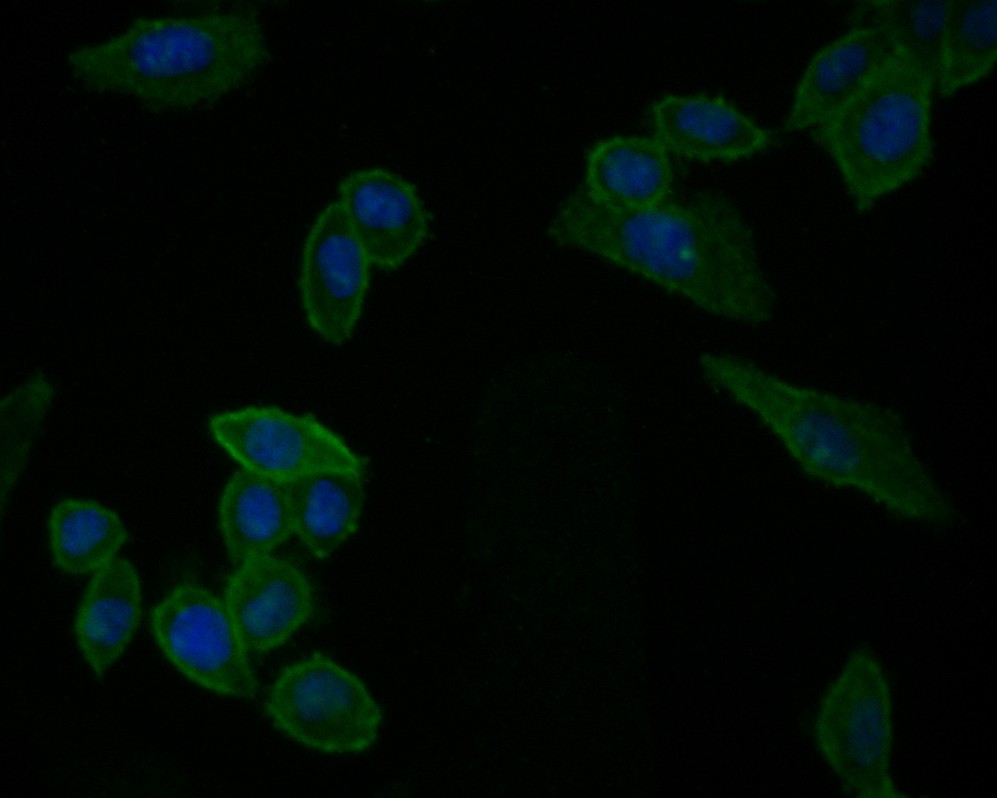 Fig4:; ICC staining of IL-7 in SiHa cells (green). Formalin fixed cells were permeabilized with 0.1% Triton X-100 in TBS for 10 minutes at room temperature and blocked with 10% negative goat serum for 15 minutes at room temperature. Cells were probed with the primary antibody ( 1/50) for 1 hour at room temperature, washed with PBS. Alexa Fluor®488 conjugate-Goat anti-Rabbit IgG was used as the secondary antibody at 1/1,000 dilution. The nuclear counter stain is DAPI (blue).