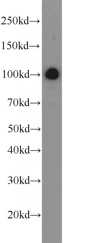 HEK-293 cells were subjected to SDS PAGE followed by western blot with Catalog No:109746(CUL4B antibody) at dilution of 1:1000