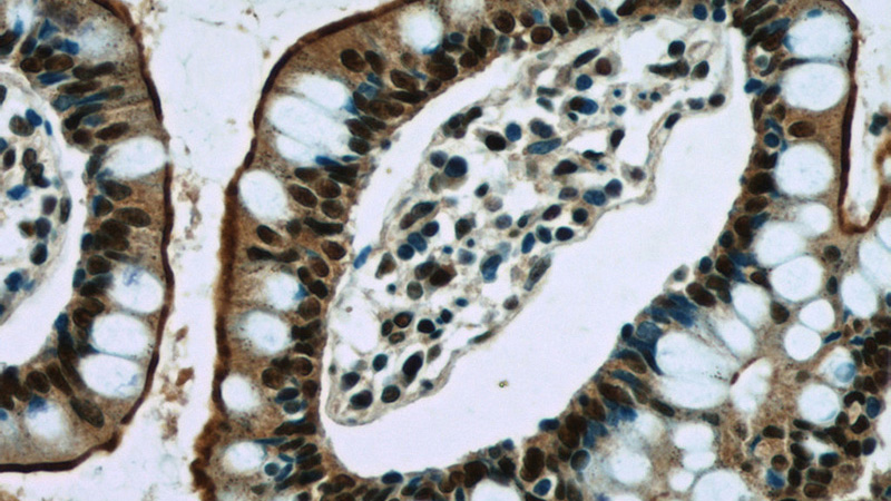 Immunohistochemistry of paraffin-embedded human small intestine slide using Catalog No:111059(GPBP1 Antibody) at dilution of 1:50