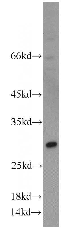 HeLa cells were subjected to SDS PAGE followed by western blot with Catalog No:116361(TSPAN31 antibody) at dilution of 1:400