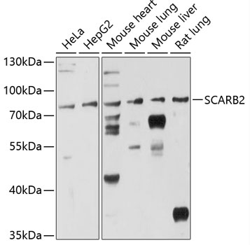 Western blot - SCARB2 Polyclonal Antibody 