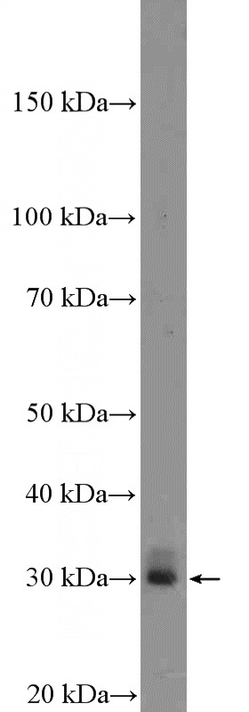 mouse testis tissue were subjected to SDS PAGE followed by western blot with Catalog No:110251(C10orf63 Antibody) at dilution of 1:1000