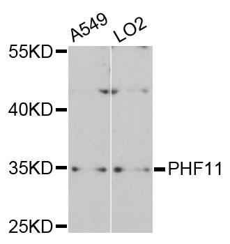 Western blot - PHF11 Polyclonal Antibody 
