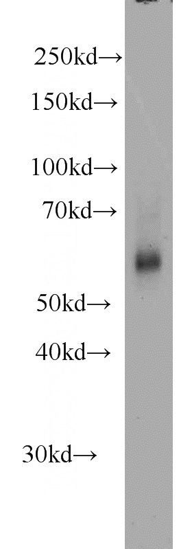 mouse heart tissue were subjected to SDS PAGE followed by western blot with Catalog No:112261(KMO antibody) at dilution of 1:1000