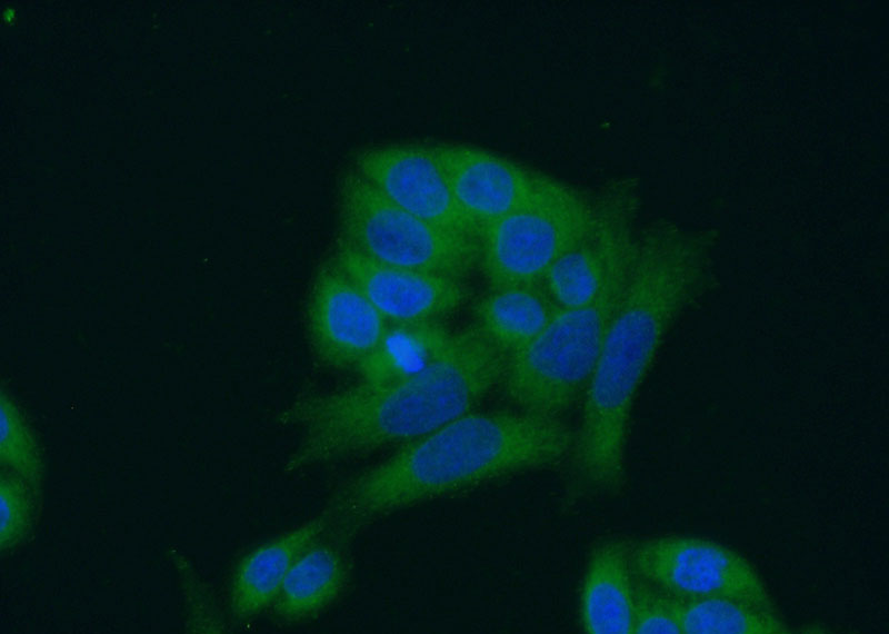 Immunofluorescent analysis of (-20oc Ethanol) fixed HeLa cells using Catalog No:108070(ANKRD16 Antibody) at dilution of 1:50 and Alexa Fluor 488-congugated AffiniPure Goat Anti-Rabbit IgG(H+L)