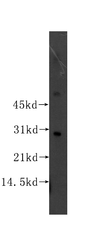 mouse pancreas tissue were subjected to SDS PAGE followed by western blot with Catalog No:115442(SNAI2 antibody) at dilution of 1:300