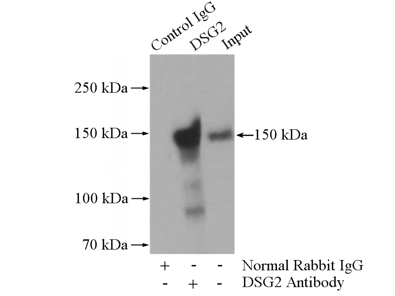 IP Result of anti-DSG2 (IP:Catalog No:110027, 4ug; Detection:Catalog No:110027 1:1000) with HepG2 cells lysate 3600ug.