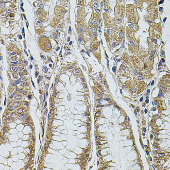 Immunohistochemistry - ALIX / PDCD6IP Polyclonal Antibody 