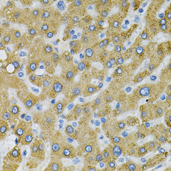 Immunohistochemistry - SDC4 Polyclonal Antibody 