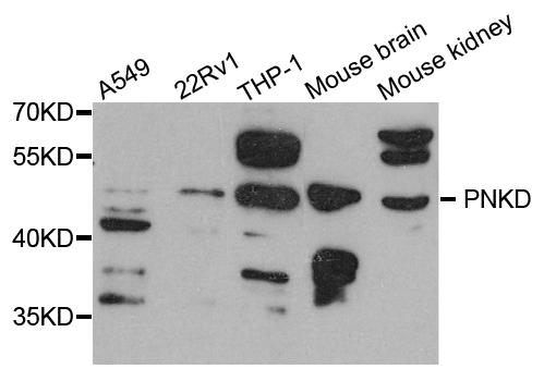 Western blot - PNKD Polyclonal Antibody 