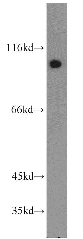 K-562 cells were subjected to SDS PAGE followed by western blot with Catalog No:114531(RALBP1 antibody) at dilution of 1:800