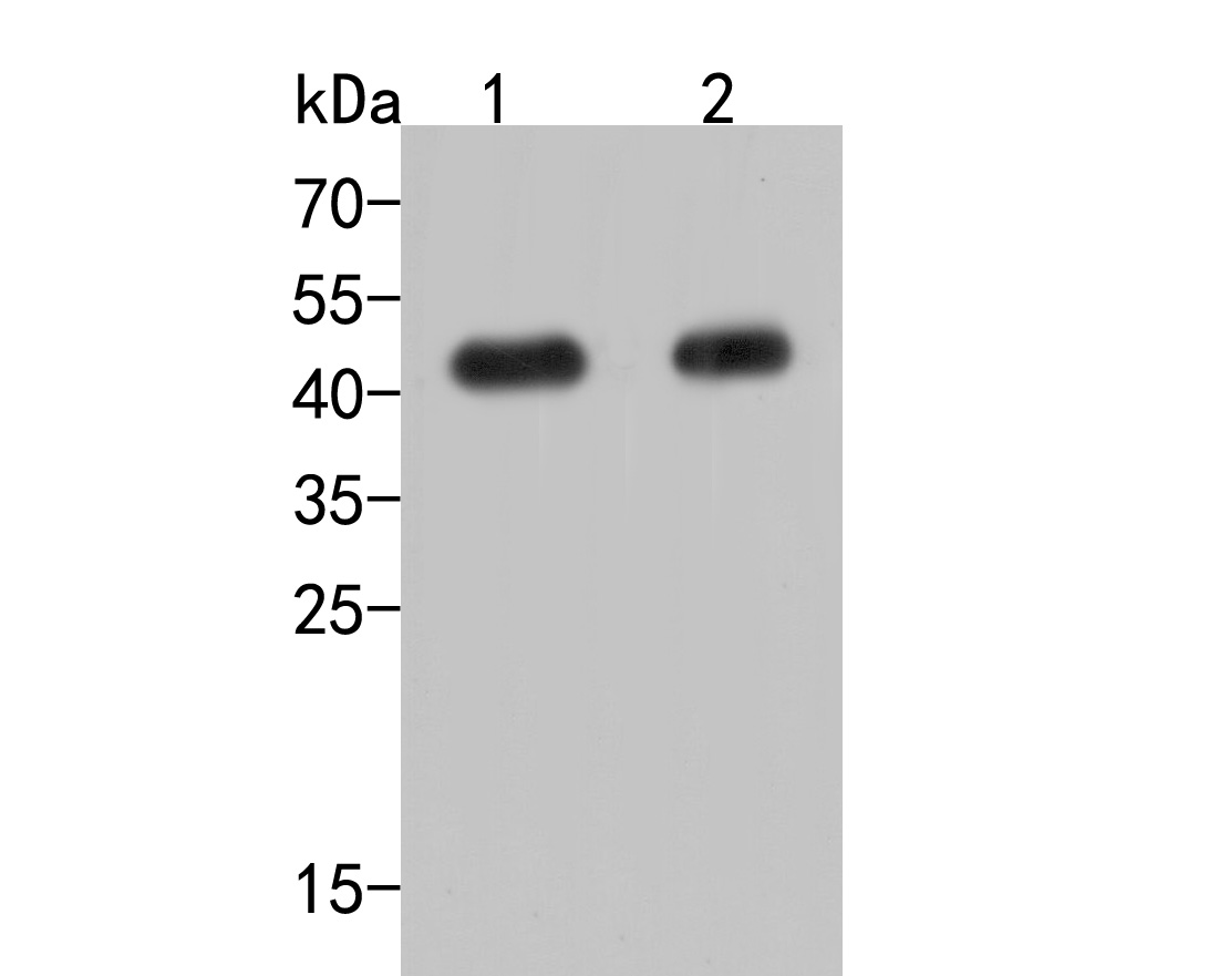 Fig1:; Western blot analysis of TMEM119 on different lysates. Proteins were transferred to a PVDF membrane and blocked with 5% NFDM/TBST for 1 hour at room temperature. The primary antibody ( 1/500) was used in 5% NFDM/TBST at room temperature for 2 hours. Goat Anti-Rabbit IgG - HRP Secondary Antibody (HA1001) at 1:200,000 dilution was used for 1 hour at room temperature.; Positive control:; Lane 1: Mouse brain tissue lysate; Lane 2: Mouse cerebellum tissue lysate