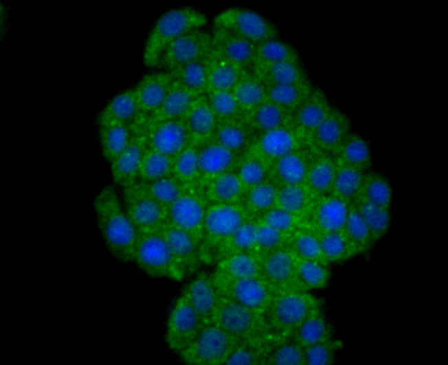 Fig2: ICC staining TrkA in PC-12 cells (green). The nuclear counter stain is DAPI (blue). Cells were fixed in paraformaldehyde, permeabilised with 0.25% Triton X100/PBS.