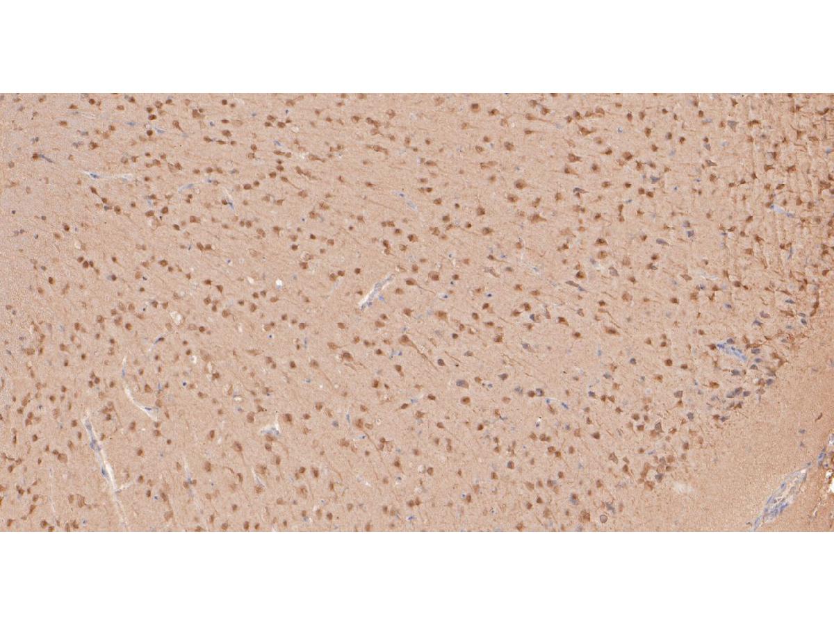 Fig3:; Immunohistochemical analysis of paraffin-embedded mouse brain tissue using anti-MyT1L antibody. The section was pre-treated using heat mediated antigen retrieval with sodium citrate buffer (pH 6.0) for 20 minutes. The tissues were blocked in 5% BSA for 30 minutes at room temperature, washed with ddH; 2; O and PBS, and then probed with the primary antibody ( 1/400) for 30 minutes at room temperature. The detection was performed using an HRP conjugated compact polymer system. DAB was used as the chromogen. Tissues were counterstained with hematoxylin and mounted with DPX.