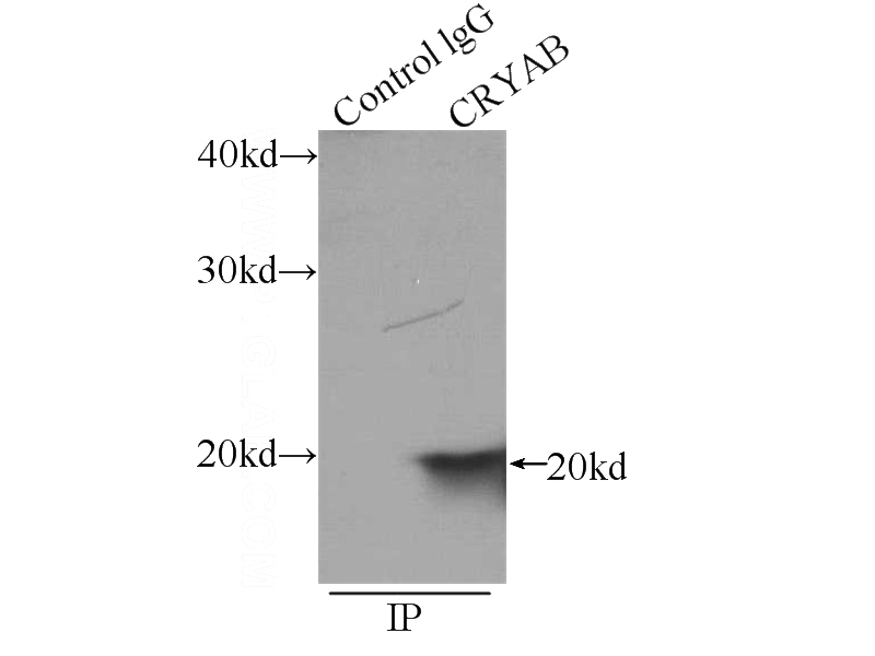IP Result of anti-aB-Crystallin (IP:Catalog No:107868, 3ug; Detection:Catalog No:107868 1:500) with mouse heart tissue lysate 4000ug.