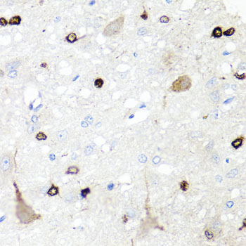 Immunohistochemistry - IGFBP5 Polyclonal Antibody 