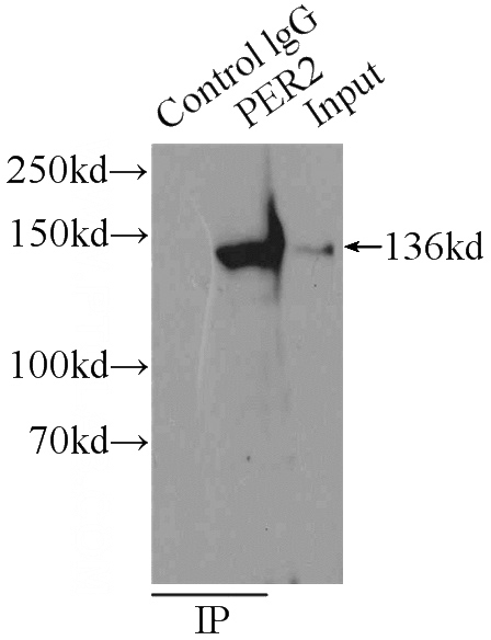 IP Result of anti-PER2 (IP:Catalog No:113712, 3ug; Detection:Catalog No:113712 1:300) with HEK-293 cells lysate 1000ug.