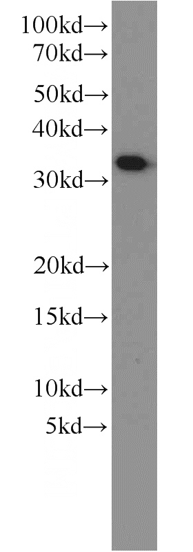 human brain tissue were subjected to SDS PAGE followed by western blot with Catalog No:112630(MEF2BNB antibody) at dilution of 1:1000