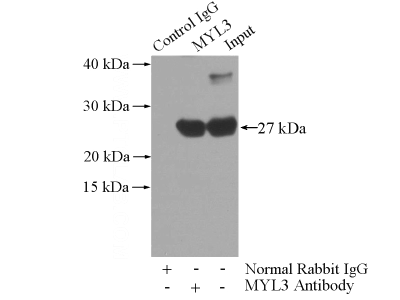 IP Result of anti-MYL3 (IP:Catalog No:112943, 3ug; Detection:Catalog No:112943 1:7000) with mouse heart tissue lysate 4000ug.