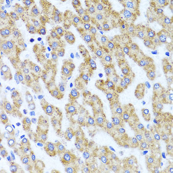 Immunohistochemistry - INADL Polyclonal Antibody 