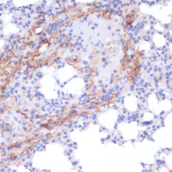 Immunohistochemistry - COL1A1 Polyclonal Antibody 