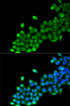 Immunofluorescence - GC Polyclonal Antibody 