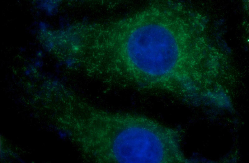 Immunofluorescent analysis of SH-SY5Y cells using Catalog No:113585(Parkin Antibody) at dilution of 1:50 and Alexa Fluor 488-congugated AffiniPure Goat Anti-Rabbit IgG(H+L)
