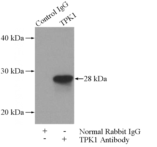 IP Result of anti-TPK1 (IP:Catalog No:116266, 4ug; Detection:Catalog No:116266 1:500) with mouse kidney tissue lysate 4000ug.