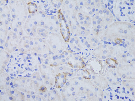 Immunohistochemistry - AQP3 Polyclonal Antibody 