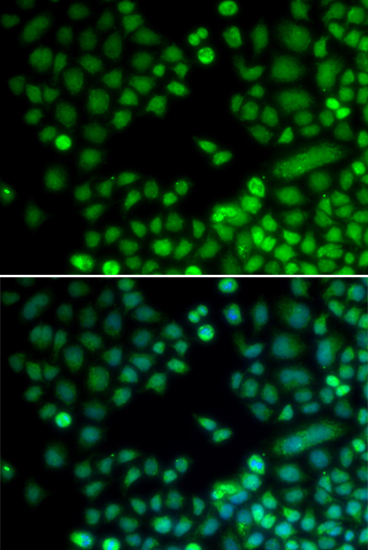 Immunofluorescence - RAD9A Polyclonal Antibody 