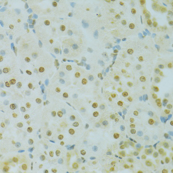 Immunohistochemistry - RCC1 Polyclonal Antibody 
