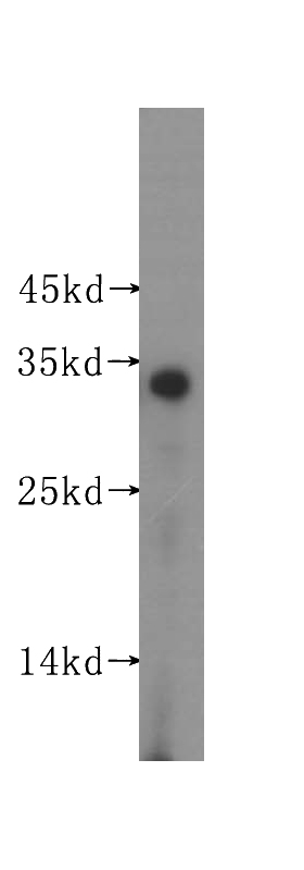 human adrenal gland tissue were subjected to SDS PAGE followed by western blot with Catalog No:115831(SULT2A1 antibody) at dilution of 1:1000