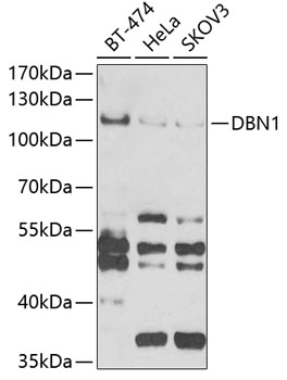 Western blot - DBN1 Polyclonal Antibody 