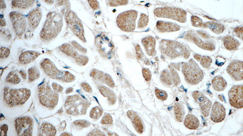 Immunohistochemistry of paraffin-embedded human heart tissue slide using Catalog No:110297(EDA Antibody) at dilution of 1:50 (under 40x lens)