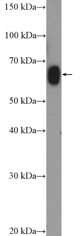 rat testis tissue were subjected to SDS PAGE followed by western blot with Catalog No:117180(ZNF470 Antibody) at dilution of 1:1000
