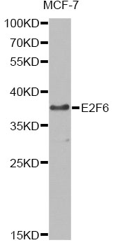 Western blot - E2F6 Polyclonal Antibody 