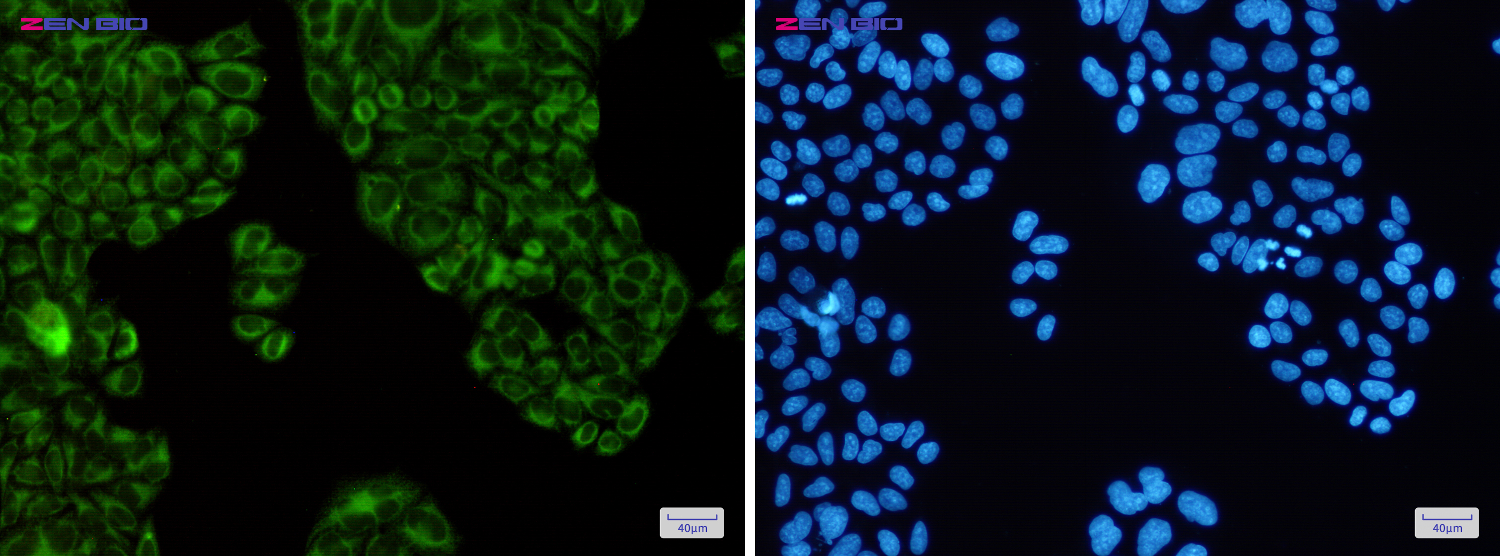 Immunocytochemistry of SERCA2 ATPase(green) in Hela cells using SERCA2 ATPase Rabbit pAb at dilution 1/50, and DAPI(blue)