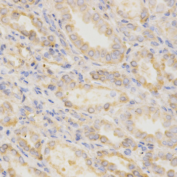 Immunohistochemistry - GGA2 Polyclonal Antibody 