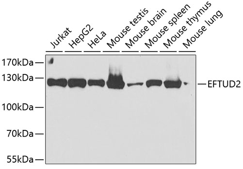 Western blot - EFTUD2 Polyclonal Antibody 