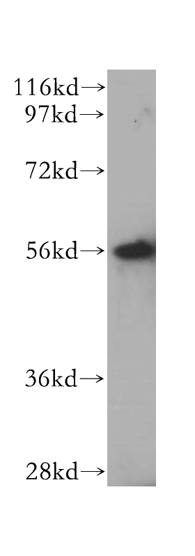 HeLa cells were subjected to SDS PAGE followed by western blot with Catalog No:112142(LAP3 antibody) at dilution of 1:300
