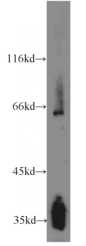 mouse brain tissue were subjected to SDS PAGE followed by western blot with Catalog No:115770(SYNPR antibody) at dilution of 1:800