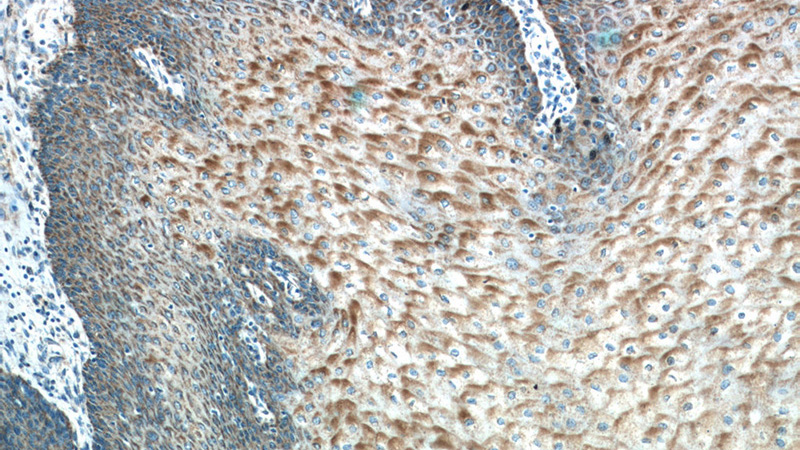 Immunohistochemistry of paraffin-embedded human oesophagus tissue slide using Catalog No:111742(IL1F9 Antibody) at dilution of 1:50 (under 10x lens)