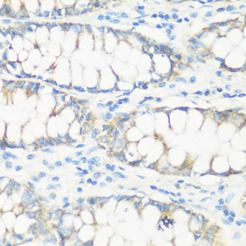 Immunohistochemistry - NMT1 Polyclonal Antibody 